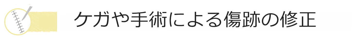 傷跡修正